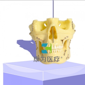 “康為醫(yī)療”種植支抗模型